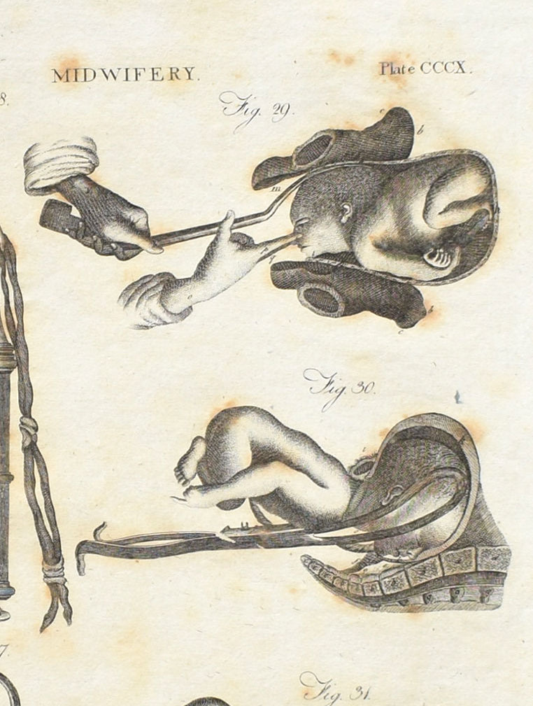 Obstetrics & Gynecology